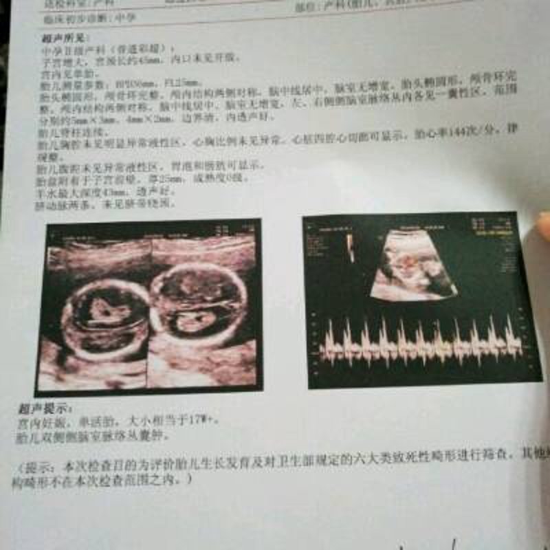 保定四维彩超